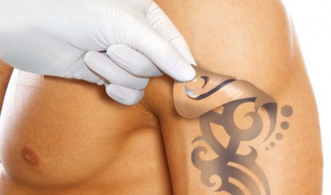 Ученые изобрели крем, который будет удалять татуировки