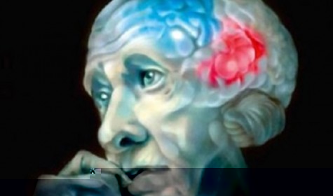 Ученые разработали новый способ диагностики болезней Альцгеймера и Паркинсона