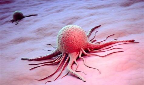 Учёные уверенны, что победить рак человечество не способно